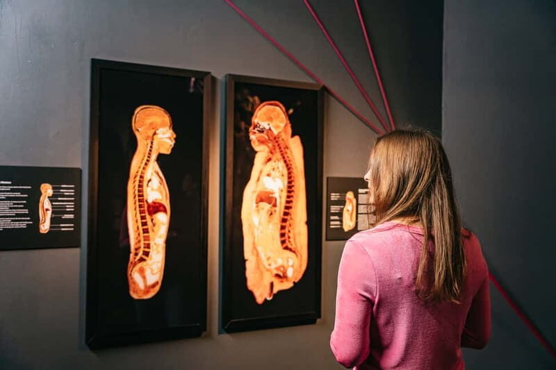 Berlin: Tickets for the BODY WORLDS Museum in Berlin - How long to plan, and when to go for your sanity